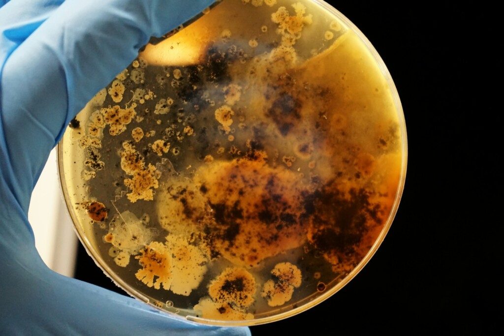 Bacteria